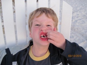 Sloan lost another tooth
